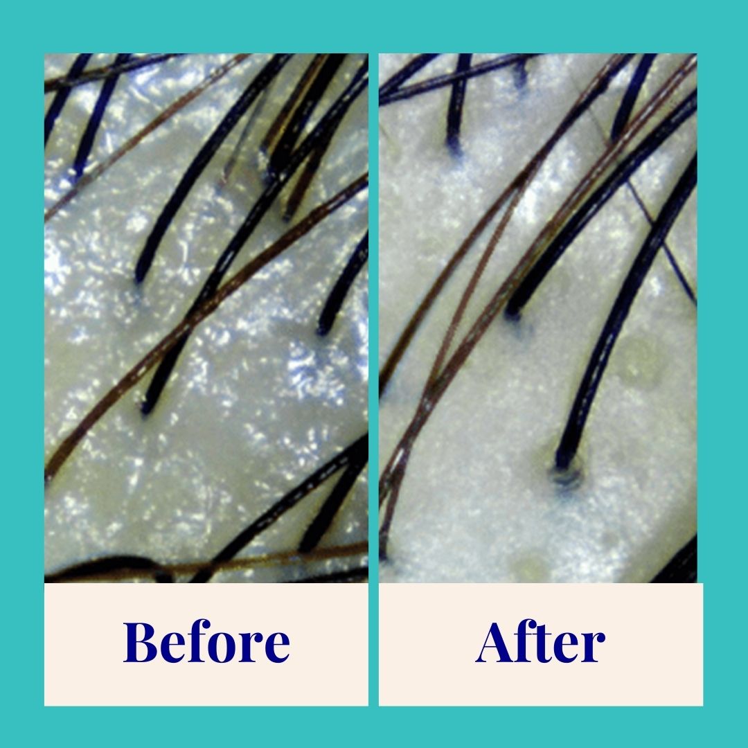 Purifying Powder Shampoo For Oily Scalp & Limp Hair (70g)
